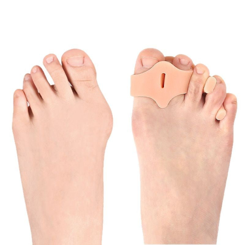 Overlapping Toe Corrector – Structured Gel Realignment Aid